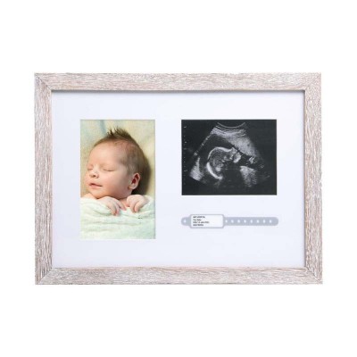 Pearhead Rustikalni okvir - Slika, sonogram in porodna ID zapestnica